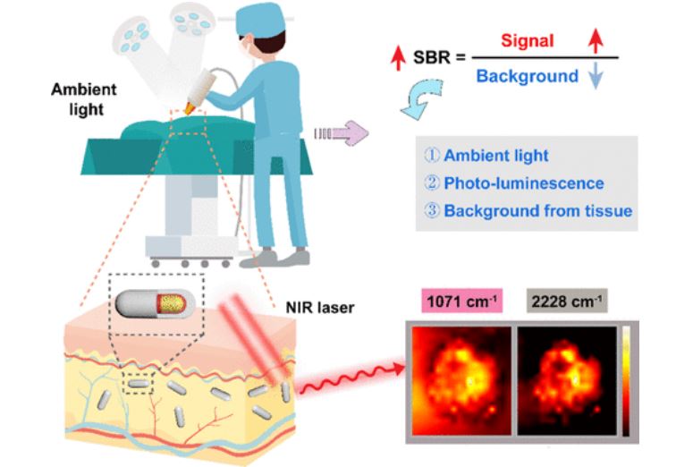 Surface-Enhanced Raman Scattering Bioimaging with an Ultrahigh Signal-to-Background Ratio under Ambient Light