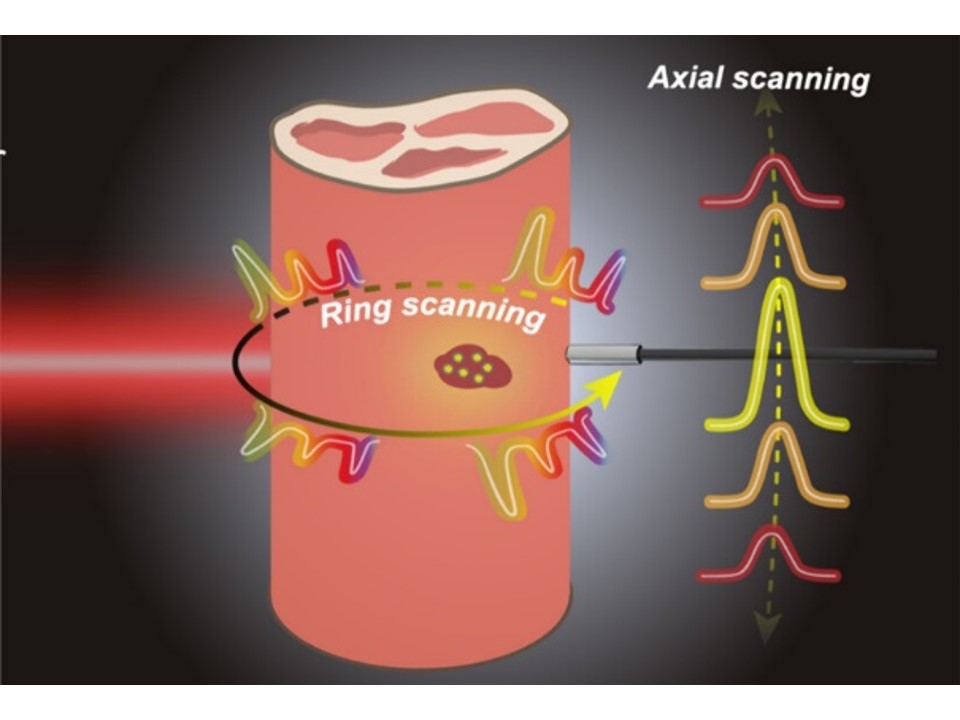 Locating Three-Dimensional Position of Deep-Seated SERS Phantom Lesions in Thick Tissues Using Tomographic Transmission Raman Spectroscopy