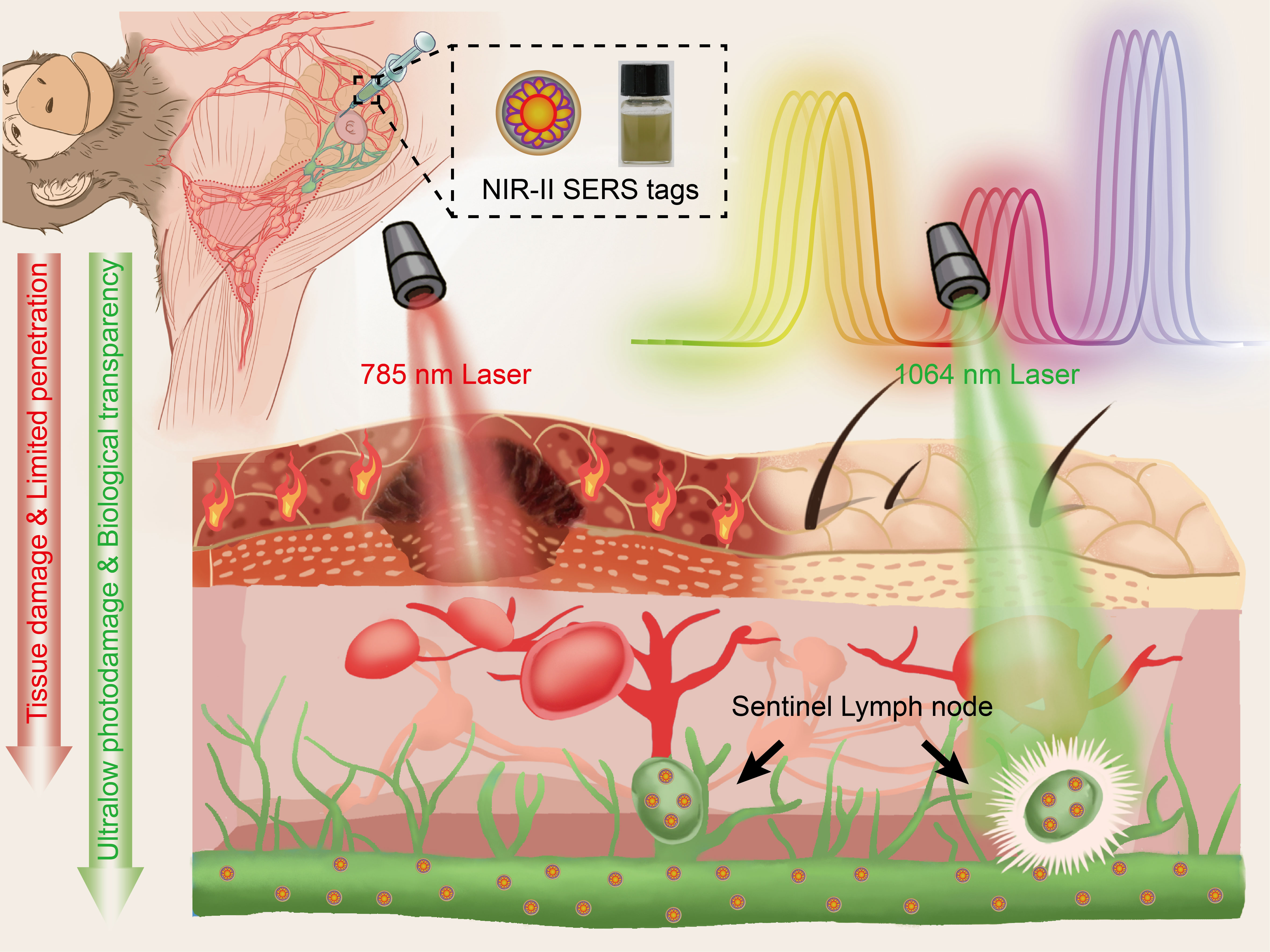 Sentinel lymph node identification using NIR-II ultrabright Raman nanotags on preclinical models