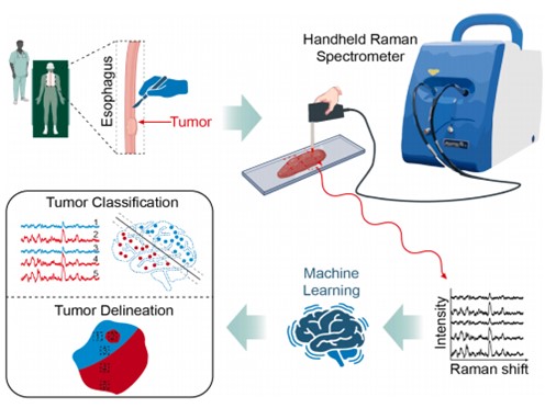 Raman spectroscopy for esophageal tumor diagnosis and delineation using machine learning and the portable Raman spectrometer