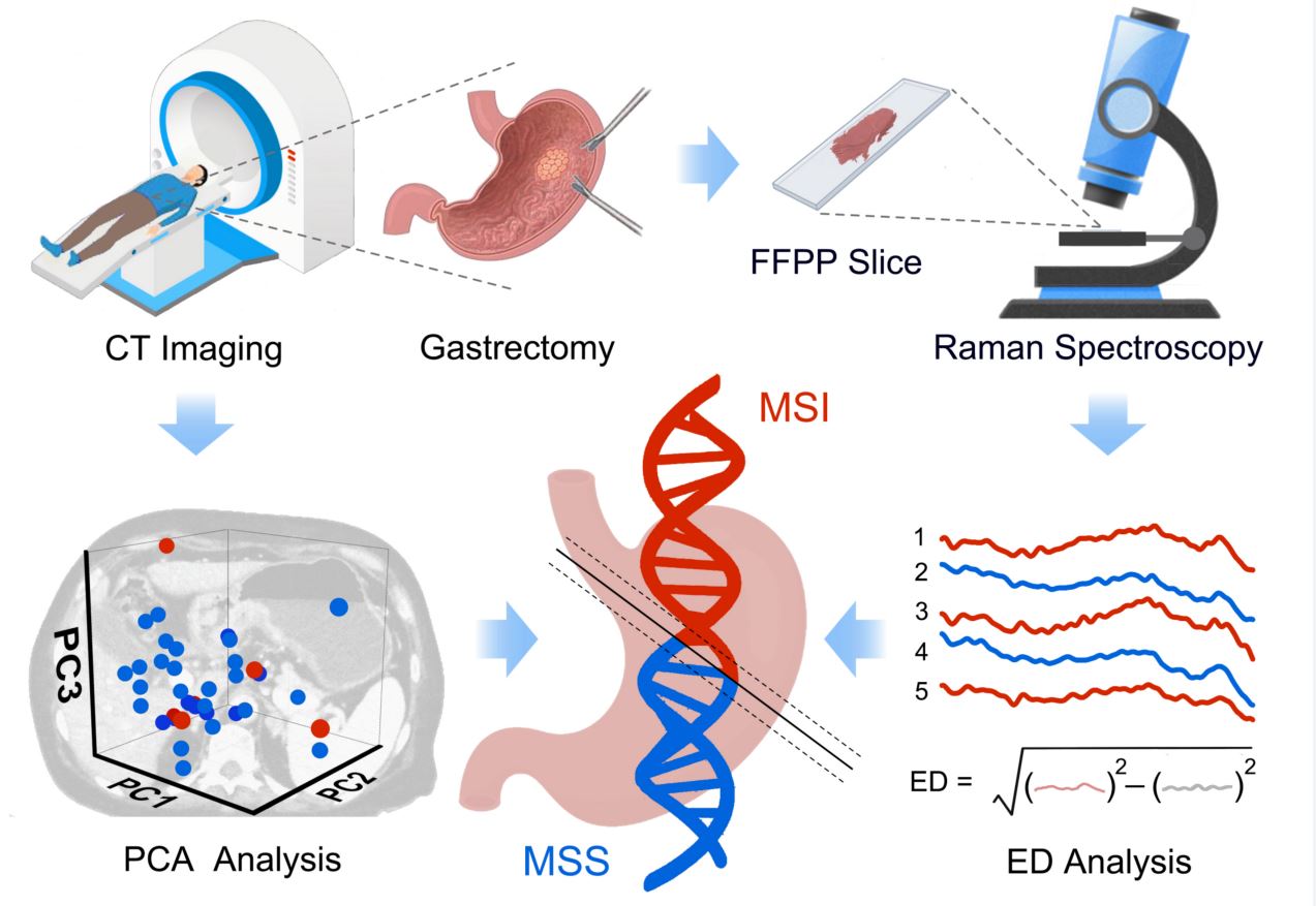 Raman spectroscopy analysis combined with computed tomography imaging to identify microsatellite instability in gastric cancers