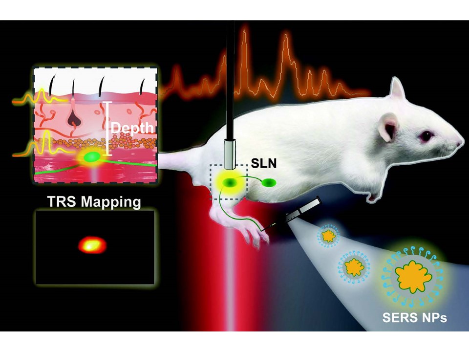 Non‐Invasive Detection, Precise Localization, and Perioperative Navigation of In Vivo Deep Lesions Using Transmission Raman Spectroscopy