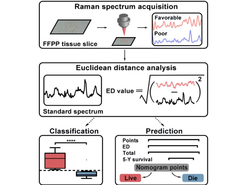 Euclidean distance-based Raman spectroscopy (EDRS) for the prognosis analysis of gastric cancer: A solution to tumor heterogeneity