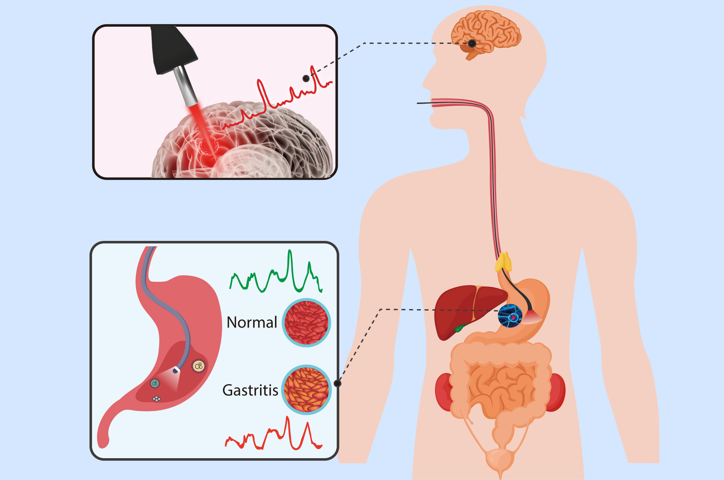 Label-free Raman spectroscopy for cancer diagnosis